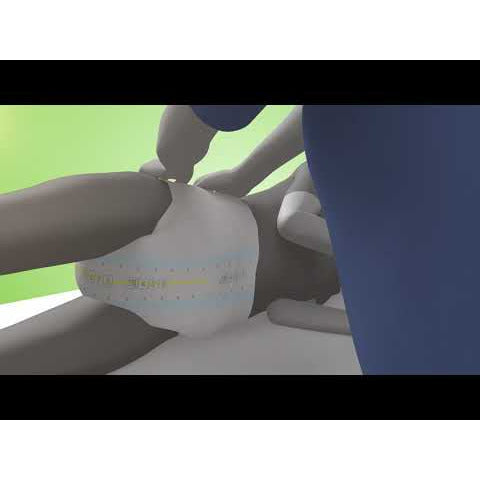 Tena Slip Maxi Small 24 Pack - Tena