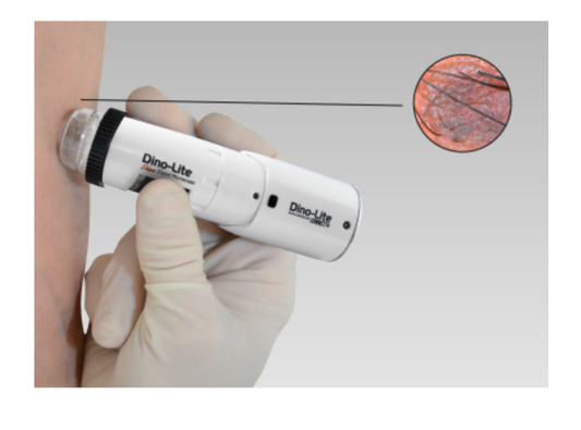 Gray DermaScope Polarizer Wireless