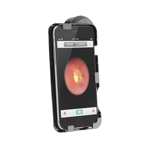 Tan Welch Allyn WELCH ALLYN iEXAMINER 6P (for iPhone 6 Plus and 6s Plus)