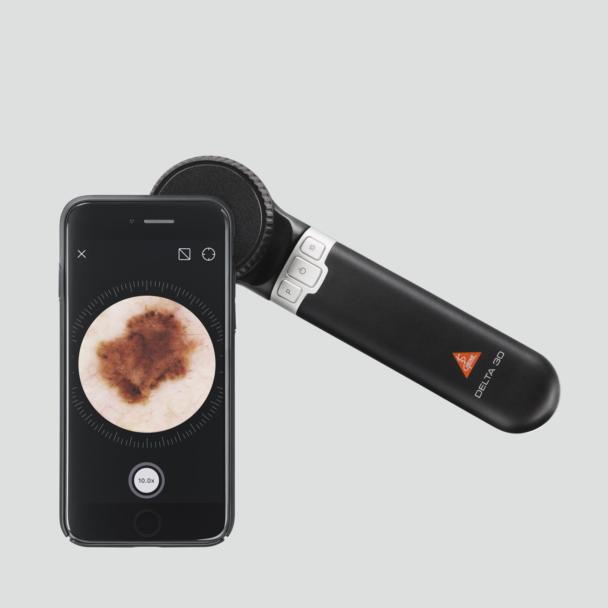 Light Gray Heine DELTA 30 Dermatoscope