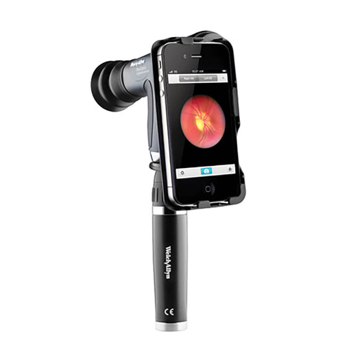 Welch Allyn WELCH ALLYN iEXAMINER 6 (for iPhone 6 and 6s) - Medscope